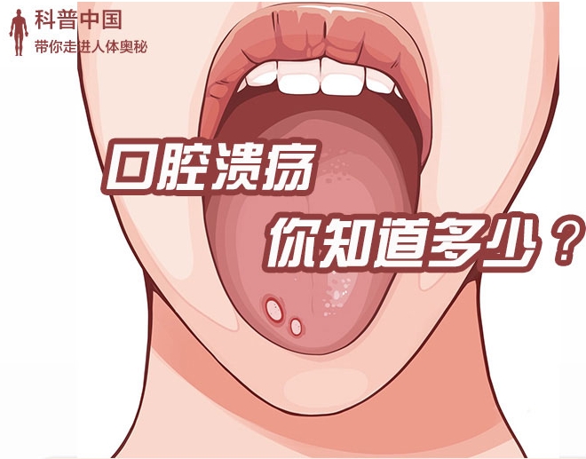 科普图解丨口腔溃疡，你知道多少？